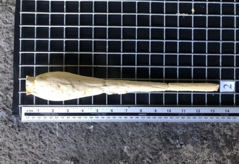 Wound profile